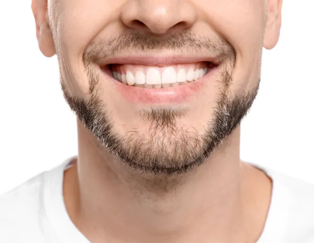 יישור שיניים שקוף